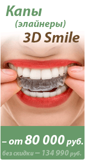 :  () 3D Smile -   75 000 .
