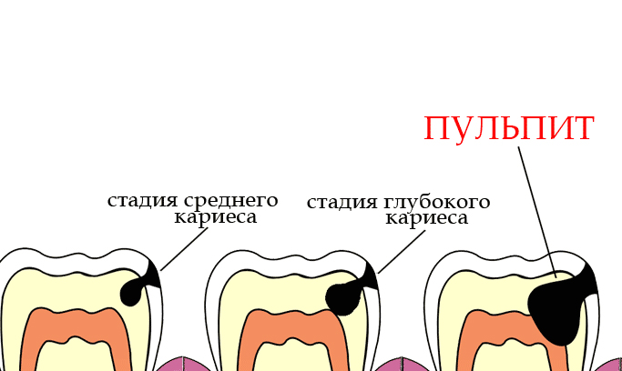 План лечения пульпита стоматологического больного образец